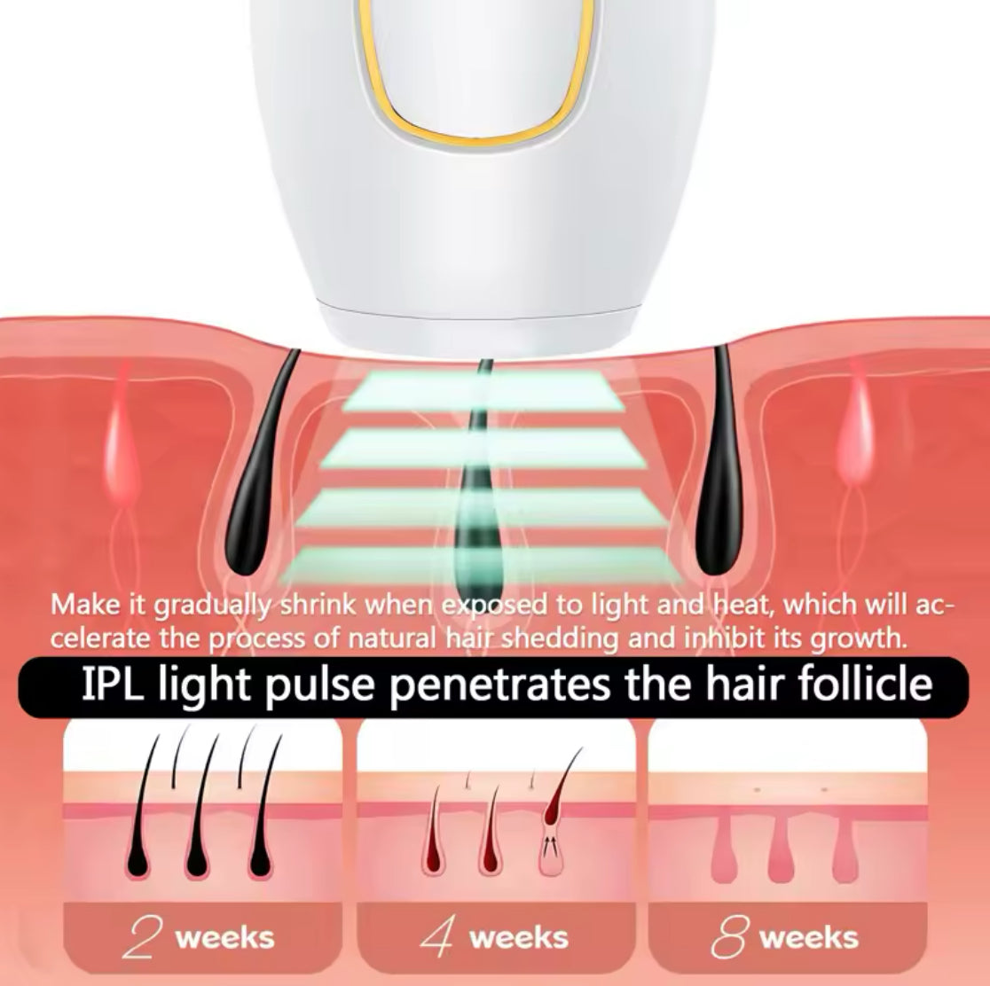 Épilateur laser IPL